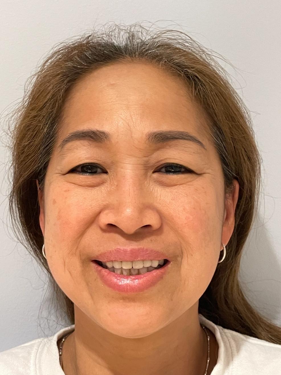 Quyen